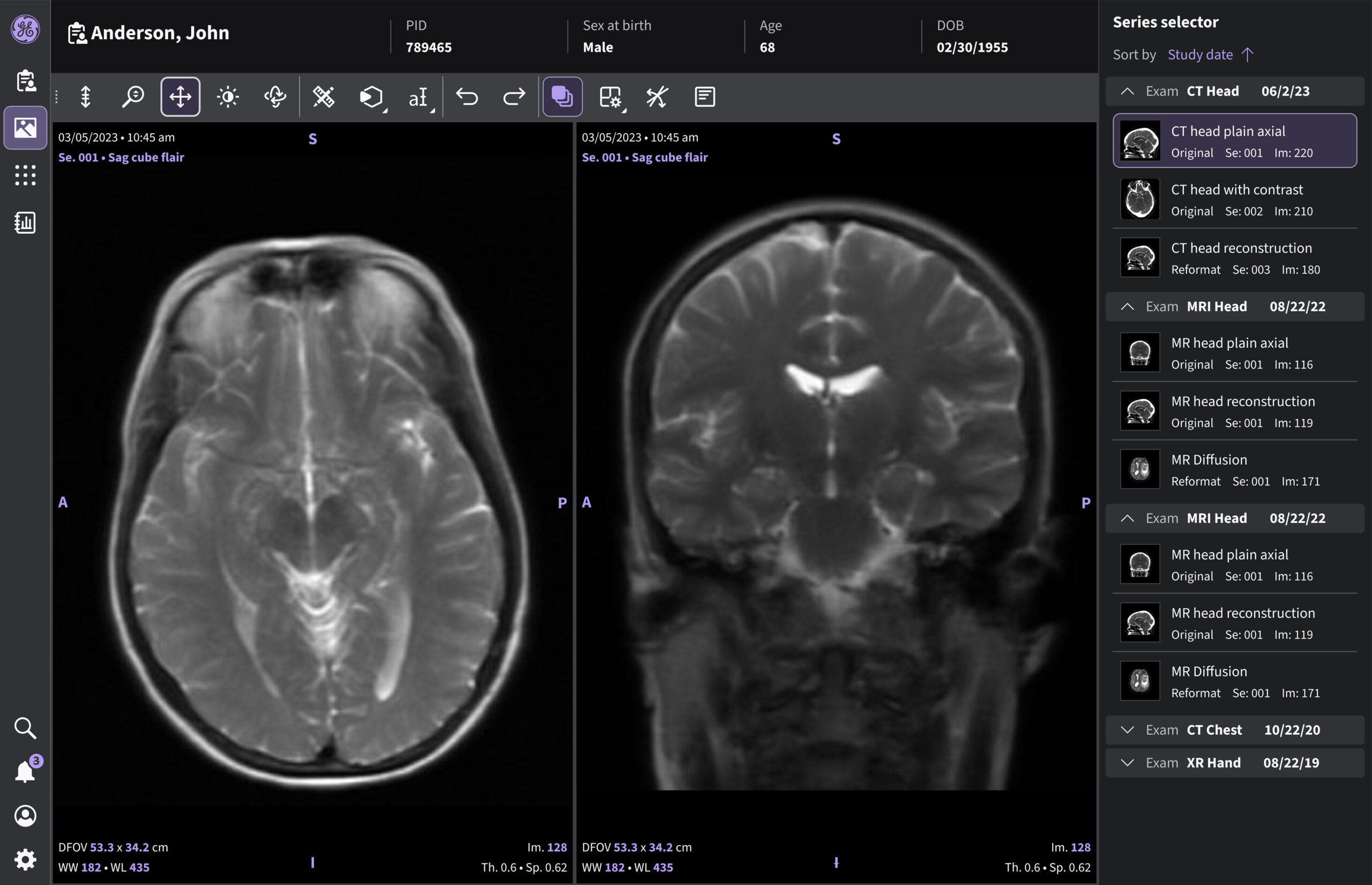 ethos-intro-mri-screen